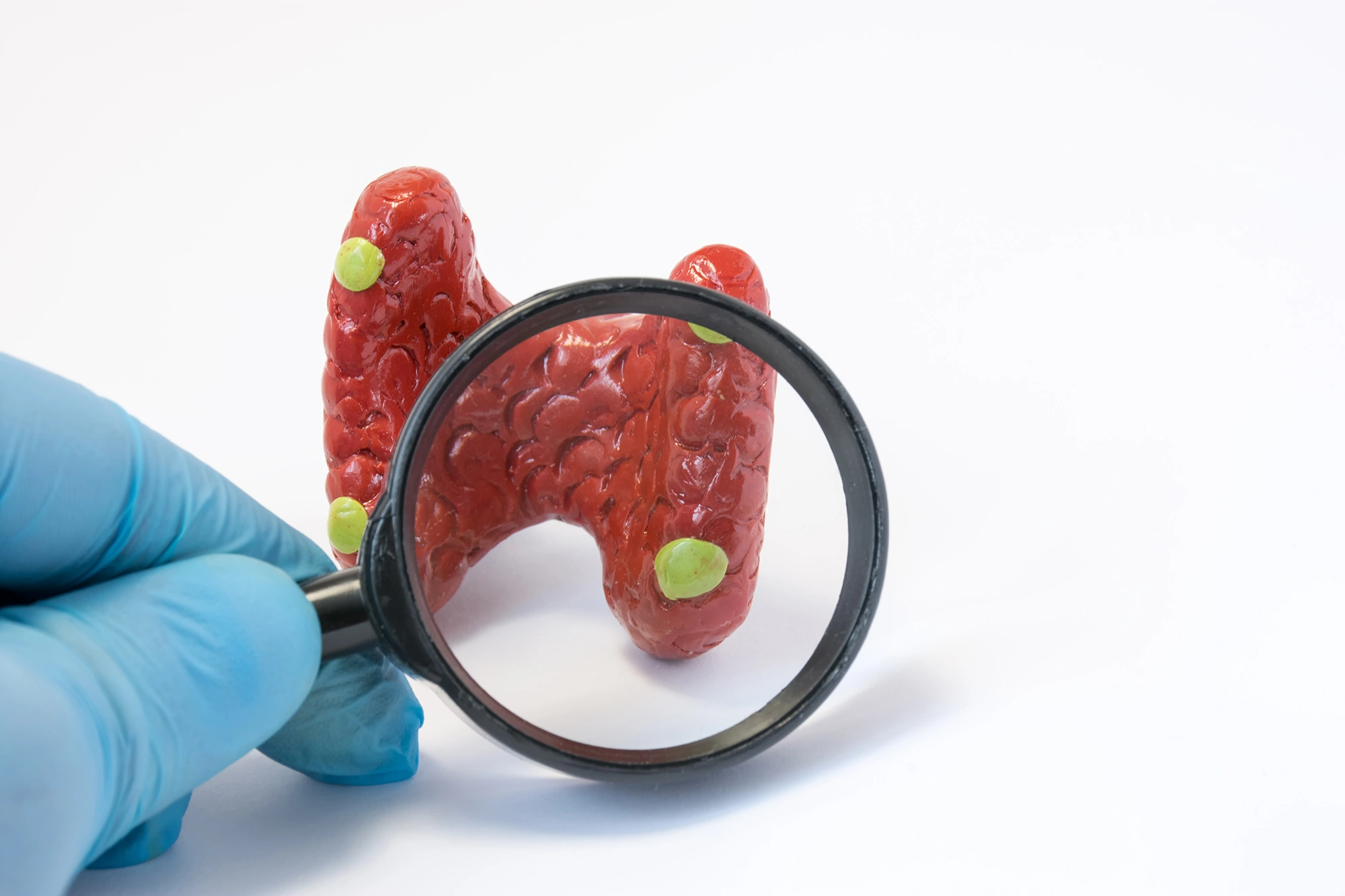 A magnifying glass used to observe a model of parathyroid glands.