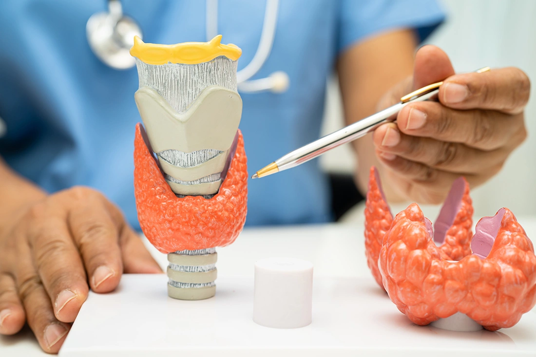 Doctor pointing at a model of an overactive thyroid gland.